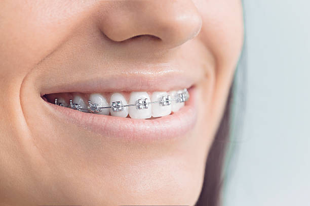 Dental Inlays and Onlays in Mcdonald, PA